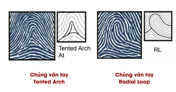 Chủng vân tay RL và TA