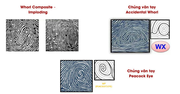 Chủng vân tay WX, WE và WC-I